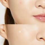 acne-pimple-master-patch-cosrx-official-5.jpg